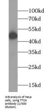 Tetratricopeptide Repeat Protein 4 (TTC4) Antibody