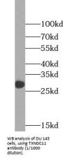 Thioredoxin Domain-Containing 11 (TXNDC11) Antibody