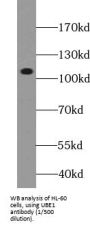 Ubiquitin-Like Modifier-Activating Enzyme 1 (UBA1) Antibody