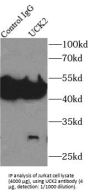 Uridine-Cytidine Kinase 2 (UCK2) Antibody