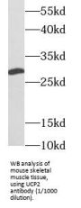 Mitochondrial Uncoupling Protein 2 (UCP2) Antibody