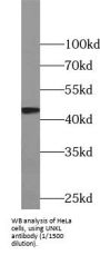 RING Finger Protein Unkempt-Like (UNKL) Antibody