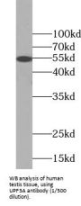Regulator of Nonsense Transcripts 3A (UPF3A) Antibody