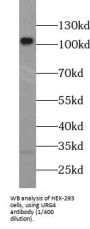 HBV X Protein Up-Regulated Gene 4 Protein (URG4) Antibody