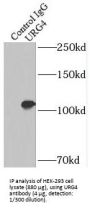 HBV X Protein Up-Regulated Gene 4 Protein (URG4) Antibody
