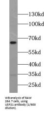 Ubiquitin Carboxyl-Terminal Hydrolase 21 (USP21) Antibody