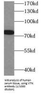 Vitronectin (VTN) Antibody
