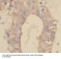 Vacuolar Protein Sorting-Associated Protein 25 (VPS25) Antibody