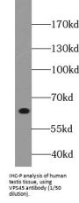 Vacuolar Protein Sorting-Associated Protein 45 (VPS45) Antibody