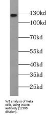 WD Repeat-Containing Protein 6 (WDR6) Antibody