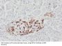 Wolframin (WFS1) Antibody