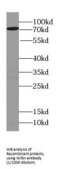 FERM Domain-Containing Protein 6 (FRMD6) Antibody