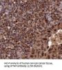 WT1 Associated Protein (WTAP) Antibody