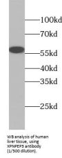 Xaa-Pro Aminopeptidase 3 (XPNPEP3) Antibody