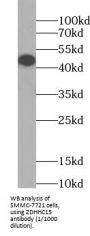Palmitoyltransferase ZDHHC15 (ZDHHC15) Antibody