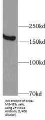 Zinc Finger FYVE Domain-Containing Protein 16 (ZFYVE16) Antibody