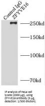 Zinc Finger FYVE Domain-Containing Protein 16 (ZFYVE16) Antibody