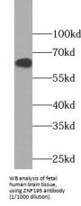 Zinc Finger Protein 195 (ZNF195) Antibody