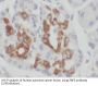 Zinc Finger Protein 2 (ZNF2) Antibody