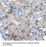 Tight Junction Protein ZO-1 (TJP1) Antibody