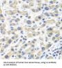 Interleukin 2 (IL2) Antibody