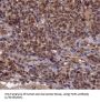 Topoisomerase I (TOP1) Antibody