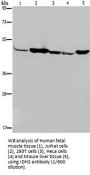 Isocitrate Dehydrogenase 2, mitochondrial (IDH2) Antibody