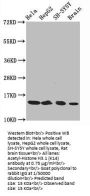 Histone H3.1 Acetyl-Lys14 (H3C1 AcK14) Antibody