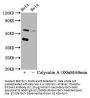 EIF2AK2 (pT446) Antibody