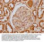 EIF2AK2 (pT446) Antibody
