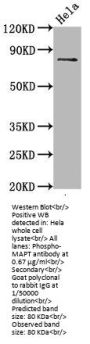 Microtubule-Associated Protein Tau Phospho-Ser396 (MAPT pS396) Antibody