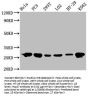 HSPB1 Antibody