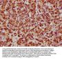 HSPB1 Antibody