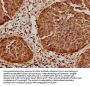HSPB1 Antibody