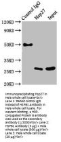 HSPB1 Antibody