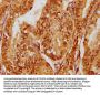 FOXO3 Antibody