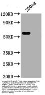 SARS-CoV-2 Nucleocapsid Protein Antibody
