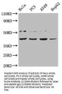 Double Homeobox Protein 4 (DUX4) Antibody