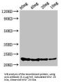 Translational Regulator CsrA (csrA) Antibody
