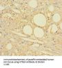 5-Hydroxytryptamine Receptor 2A (HTR2A) Antibody