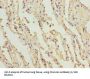 Collagen Type XII Alpha 1 (COL12A1) Antibody