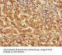 Myosin VIIA (MYO7A) Antibody