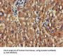 Activated Leukocyte Cell Adhesion Molecule / CD166 (ALCAM) Antibody