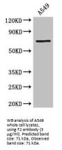 Coagulation Factor II, Thrombin / Prothrombin (F2) Antibody