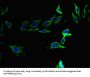 Coagulation Factor II, Thrombin / Prothrombin (F2) Antibody