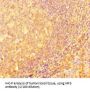 Interferon Regulatory Factor 5 (IRF5) Antibody