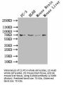 Sodium- and Chloride-Dependent Taurine Transporter (SLC6A6) Antibody