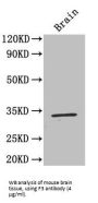Coagulation Factor III, Tissue Factor / CD142 (F3) Antibody