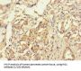 RAB6A-GEF Complex Partner Protein 1 (RIC1) Antibody