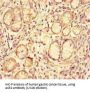 Angiotensin-Converting Enzyme 2 (ACE2) Antibody
